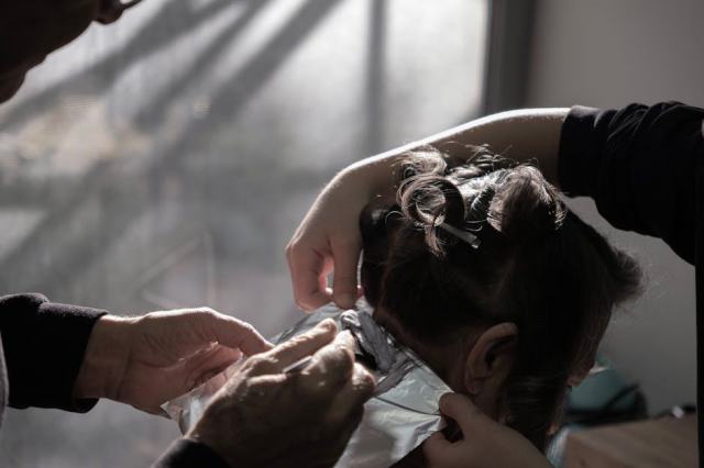 Blog capillaire : comprendre la greffe de cheveux étape par étape Blog capillaire : comprendre la greffe de cheveux étape par étape