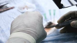 Coût moyen d'une transplantation de cheveux en 2026